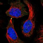 IGFN1 Polyclonal Antibody