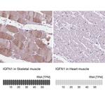 IGFN1 Antibody in Immunohistochemistry (IHC)