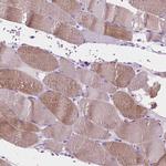 IGFN1 Antibody in Immunohistochemistry (IHC)