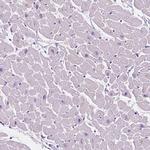 IGFN1 Antibody in Immunohistochemistry (IHC)