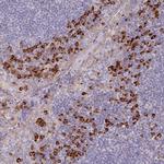 TRAPPC10 Polyclonal Antibody
