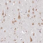 RPL28 Antibody in Immunohistochemistry (Paraffin) (IHC (P))