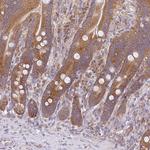 RPL28 Antibody in Immunohistochemistry (Paraffin) (IHC (P))