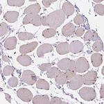 TMEM38A Polyclonal Antibody