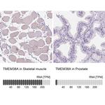 TMEM38A Antibody in Immunohistochemistry (IHC)