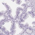 TMEM38A Antibody in Immunohistochemistry (IHC)