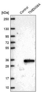 TMEM38A Antibody in Western Blot (WB)