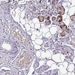 C11orf91 Polyclonal Antibody