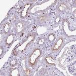 TMEM200C Polyclonal Antibody