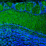 DPP6 Polyclonal Antibody