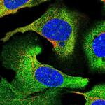 STEAP3 Polyclonal Antibody