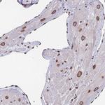 ZBTB1 Antibody in Immunohistochemistry (IHC)