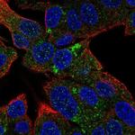 HSD3B7 Polyclonal Antibody