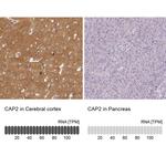 CAP2 Antibody in Immunohistochemistry (IHC)