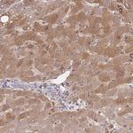 ZNF304 Antibody in Immunohistochemistry (Paraffin) (IHC (P))