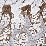 LRRC42 Antibody in Immunohistochemistry (IHC)