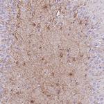 ZNF311 Polyclonal Antibody