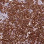NDUFAF6 Polyclonal Antibody