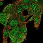 UBE2G1 Polyclonal Antibody