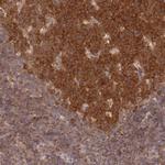 UBE2G1 Antibody in Immunohistochemistry (Paraffin) (IHC (P))