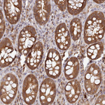 UBE2G1 Antibody in Immunohistochemistry (Paraffin) (IHC (P))