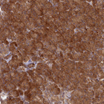 UBE2G1 Antibody in Immunohistochemistry (Paraffin) (IHC (P))