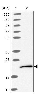 UBE2G1 Antibody in Western Blot (WB)