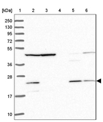 MRPL17 Antibody in Western Blot (WB)