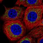 FMC1 Polyclonal Antibody