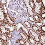 FMC1 Antibody in Immunohistochemistry (Paraffin) (IHC (P))