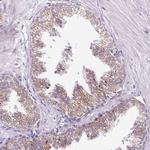 FMC1 Antibody in Immunohistochemistry (Paraffin) (IHC (P))