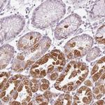 FMC1 Antibody in Immunohistochemistry (Paraffin) (IHC (P))