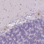 MAK16 Antibody in Immunohistochemistry (Paraffin) (IHC (P))