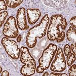 NRDE2 Antibody in Immunohistochemistry (Paraffin) (IHC (P))