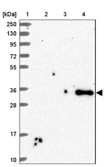 SFRP4 Antibody in Western Blot (WB)