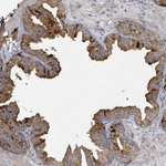 FENS1 Antibody in Immunohistochemistry (Paraffin) (IHC (P))