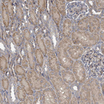 FENS1 Antibody in Immunohistochemistry (Paraffin) (IHC (P))