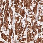 CCDC112 Antibody in Immunohistochemistry (Paraffin) (IHC (P))