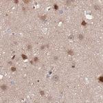 NSFL1C Antibody in Immunohistochemistry (IHC)