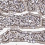 MRPS12 Antibody in Immunohistochemistry (IHC)