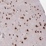 CHERP Polyclonal Antibody