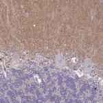TTYH1 Antibody in Immunohistochemistry (Paraffin) (IHC (P))