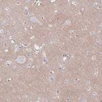 TTYH1 Antibody in Immunohistochemistry (Paraffin) (IHC (P))
