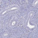 TTYH1 Antibody in Immunohistochemistry (Paraffin) (IHC (P))
