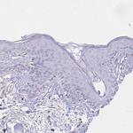 TTYH1 Polyclonal Antibody