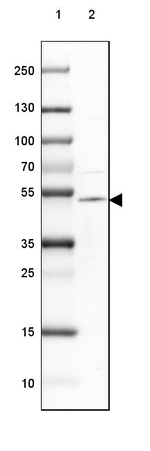TTYH1 Antibody in Western Blot (WB)