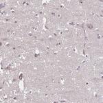 HMBS Antibody in Immunohistochemistry (IHC)