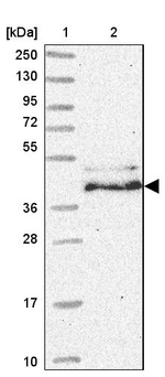 HMBS Antibody in Western Blot (WB)