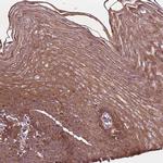 B3GALNT2 Polyclonal Antibody