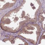 NT5DC2 Antibody in Immunohistochemistry (Paraffin) (IHC (P))